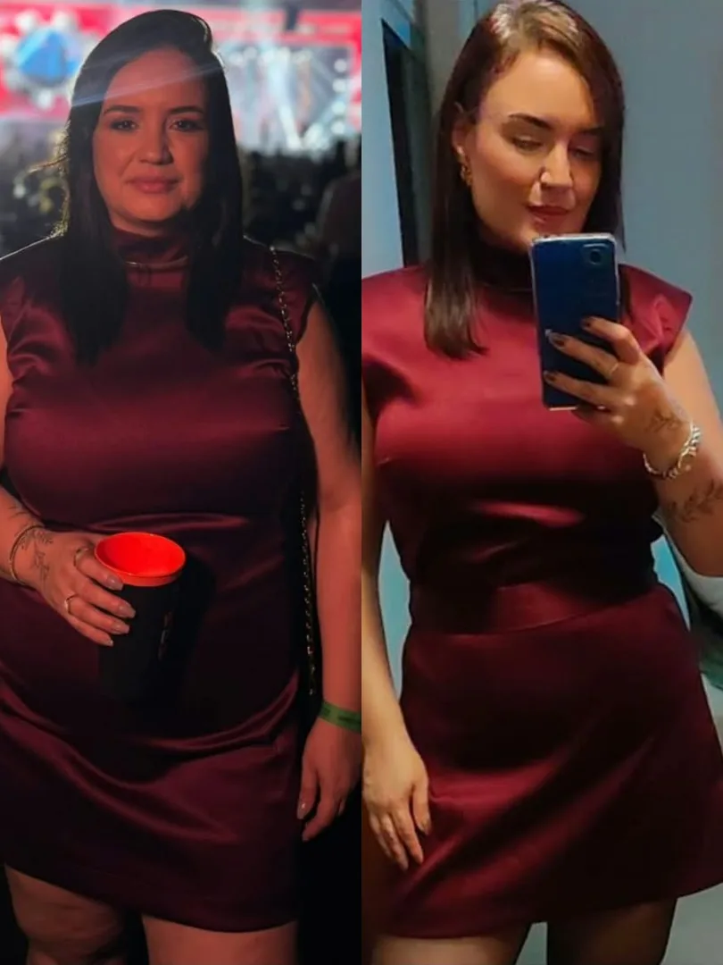 Caso 4 · Arlise, antes e depois do acompanhamento na Longevuz