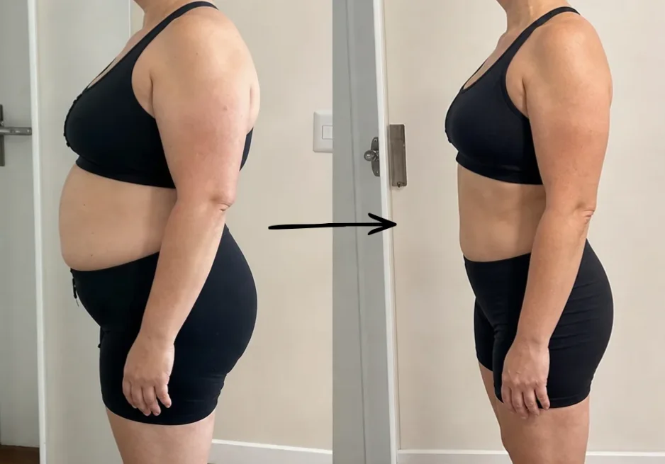 Paciente da Longevuz de perfil, antes e depois do acompanhamento médico
